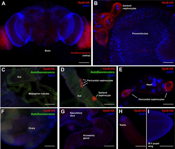 Figures and data in MiniCORVET is a Vps8-containing early endosomal ...