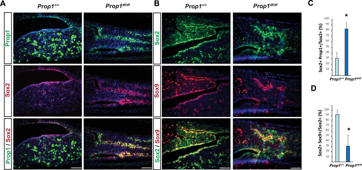 PROP1 triggers epithelial-mesenchymal transition-like process in ...