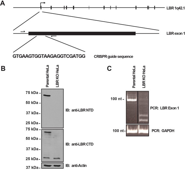 Figures And Data In The Lamin B Receptor Is Essential For Cholesterol ...