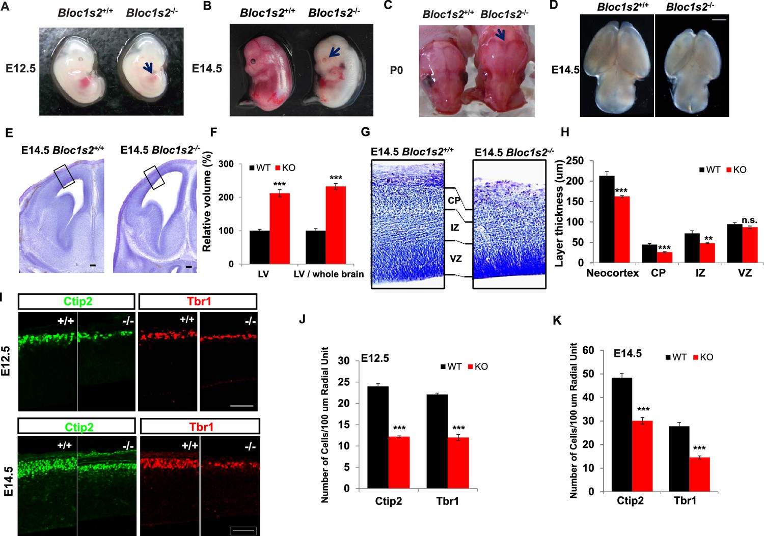 BLOS2 negatively regulates Notch signaling during neural and 