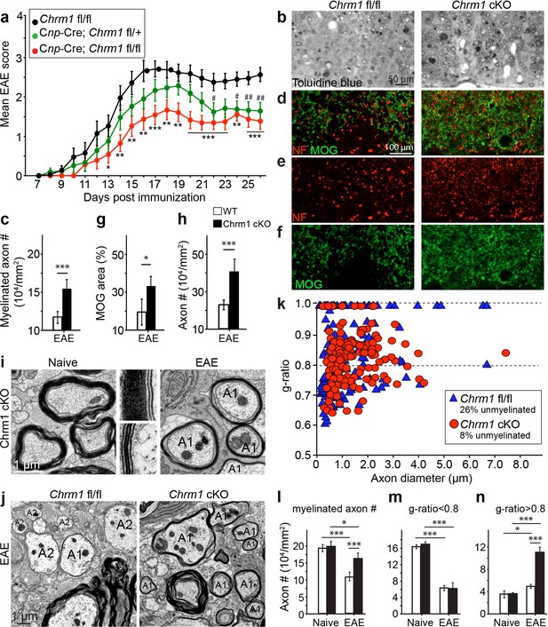 Figures and data in Accelerated remyelination during inflammatory ...