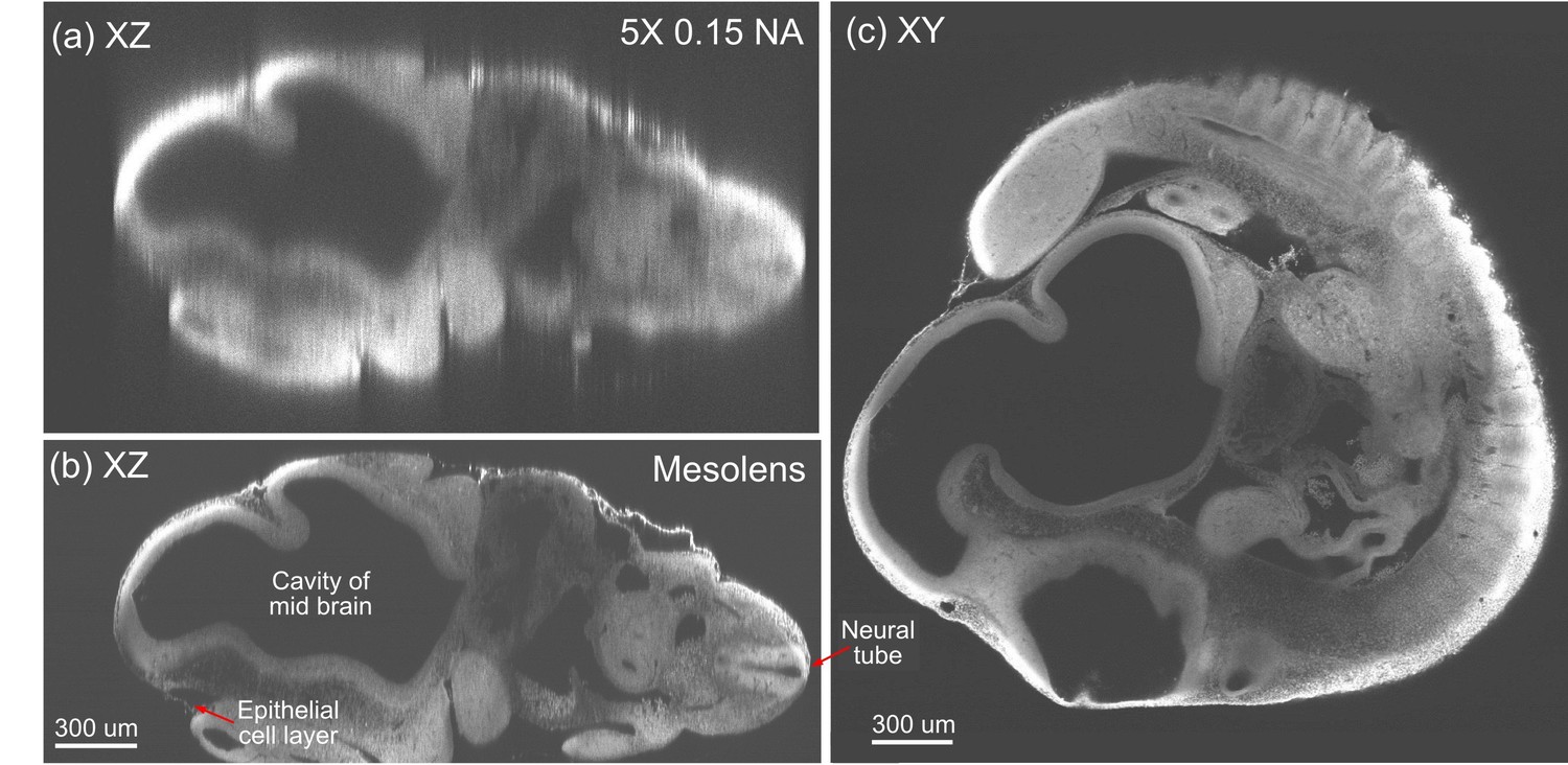 A novel optical microscope for imaging large embryos and tissue volumes ...