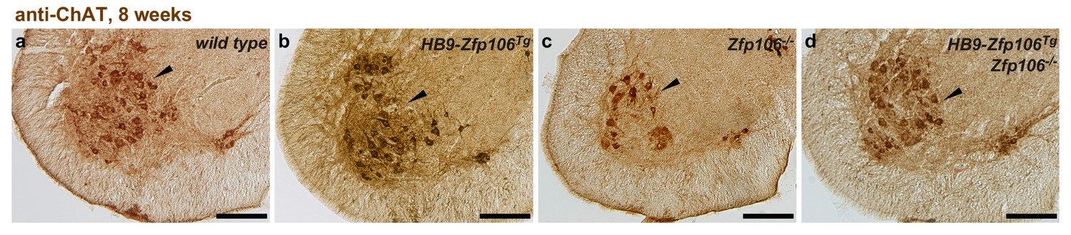 Figures and data in Suppression of C9orf72 RNA repeat-induced ...