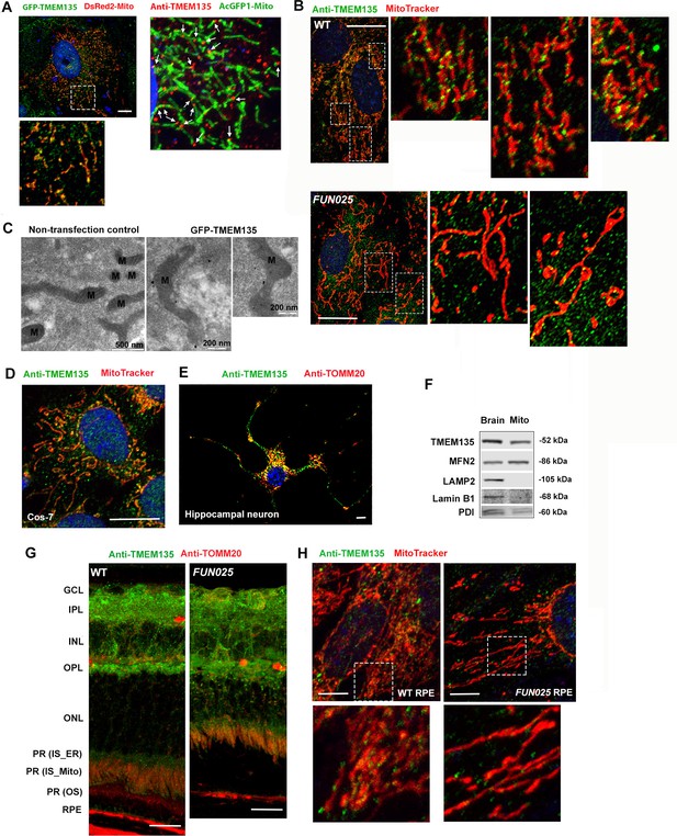 Figures and data in Mouse Tmem135 mutation reveals a mechanism ...