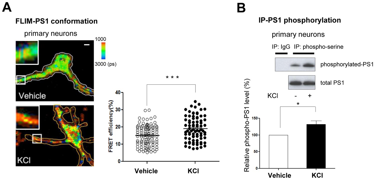 A novel and ultrasensitive electrochemical biosensor based