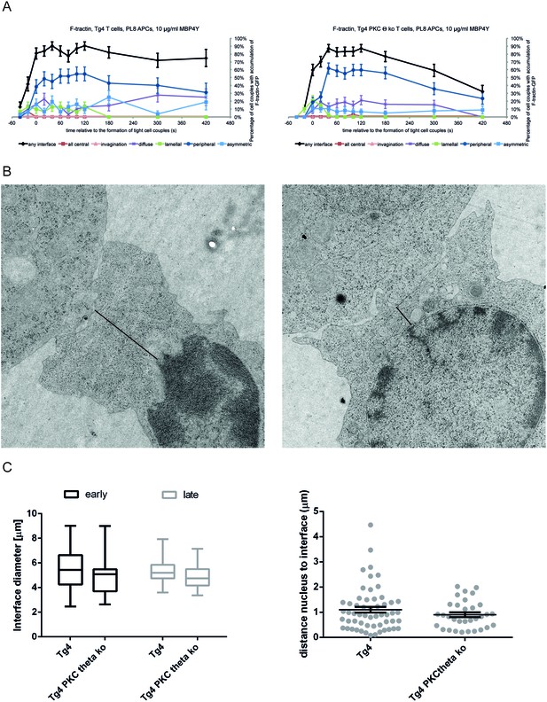 Figures And Data In Pkcθ Links Proximal T Cell And Notch Signaling 