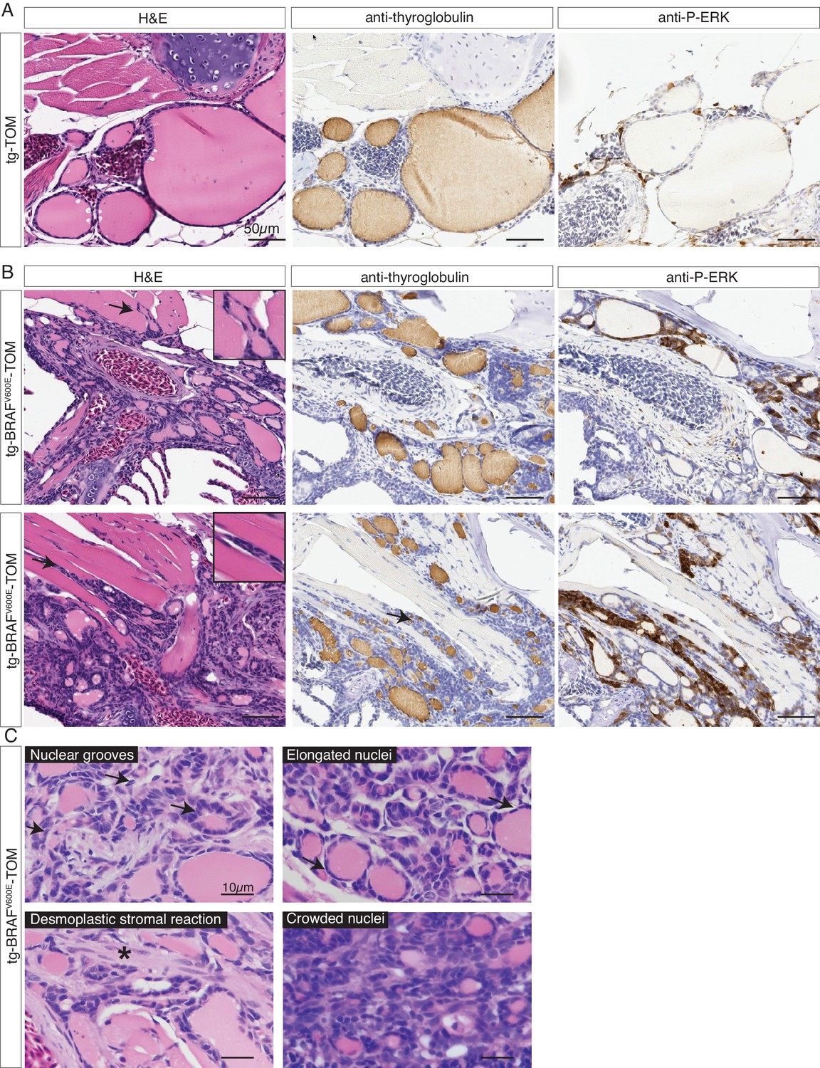 Oncogenic BRAF Disrupts Thyroid Morphogenesis And Function Via Twist