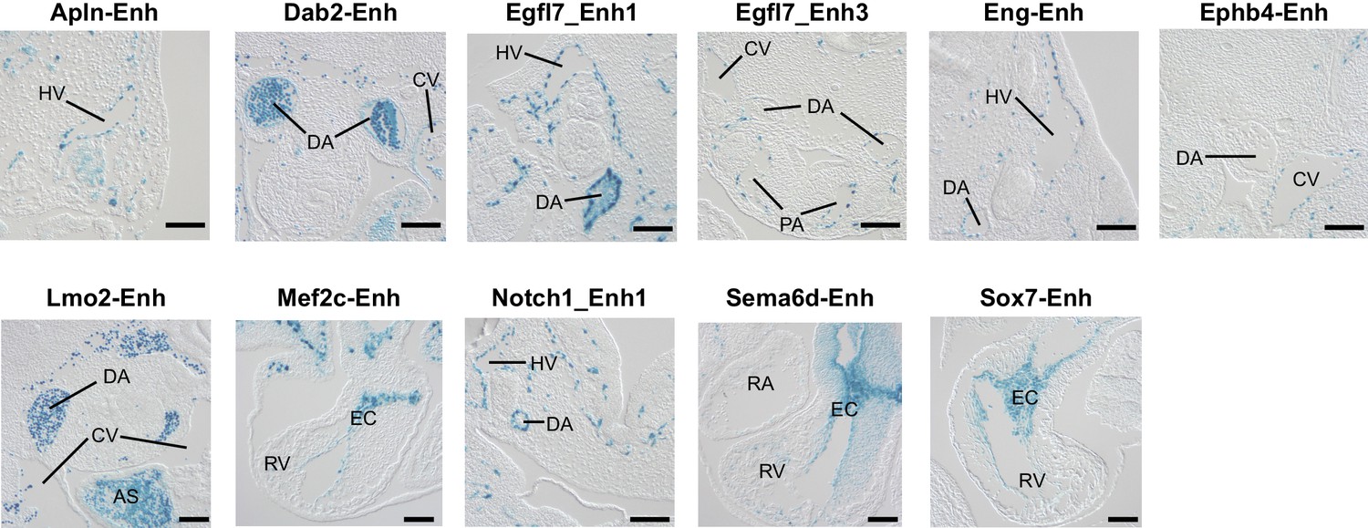 Full article: Epigenetic Association Study Uncovered H3K27
