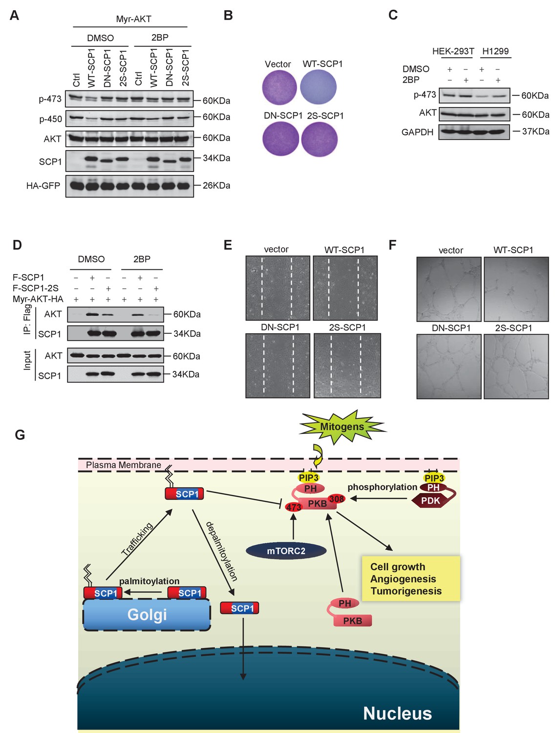 Palmitoylated SCP1 is targeted to the plasma membrane and negatively ...