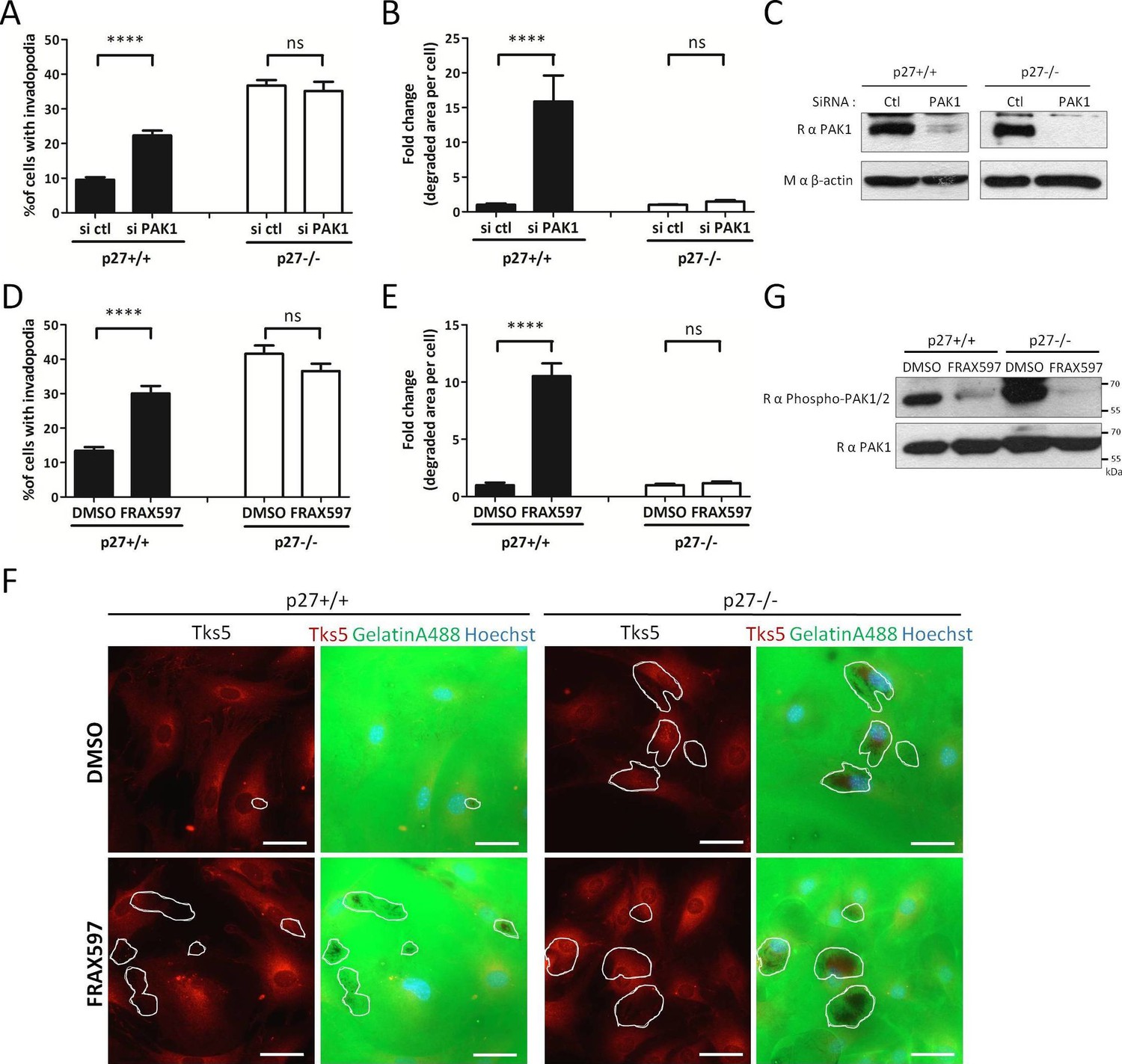 p27Kip1 promotes invadopodia turnover and invasion through the 