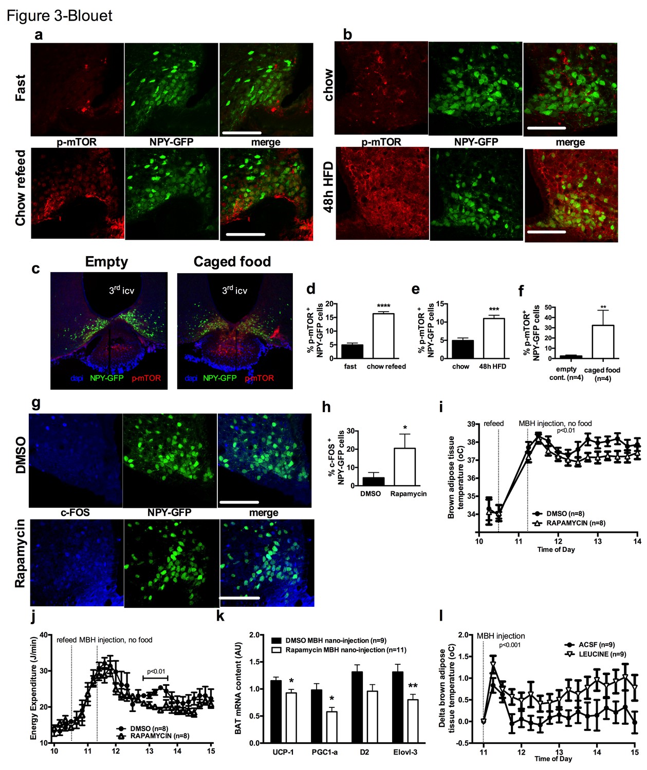 mTORC1 in AGRP neurons integrates exteroceptive and interoceptive