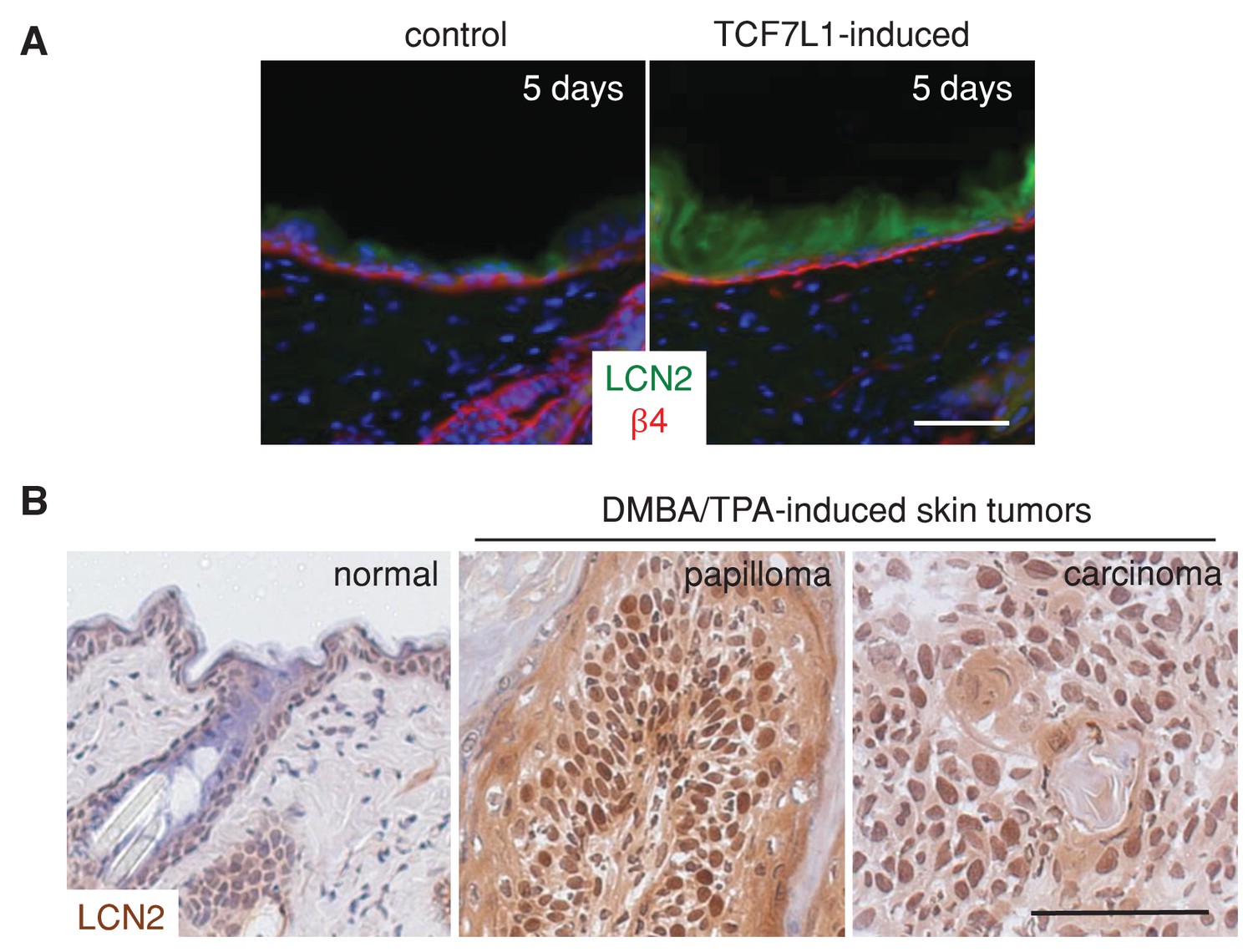 Figures And Data In Tcf L Promotes Skin Tumorigenesis Independently Of