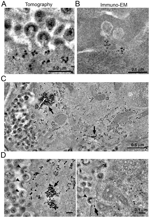 Longitudinal imaging of HIV-1 spread in humanized mice with parallel 3D ...