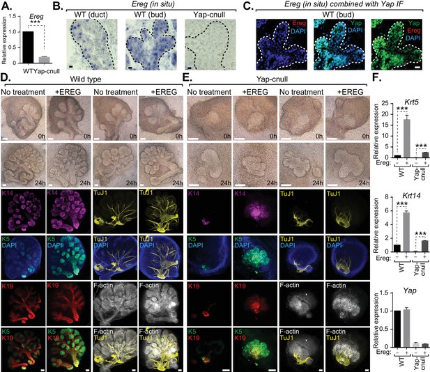 The Hippo Pathway Effector Yap Is An Essential Regulator Of Ductal Progenitor Patterning In The