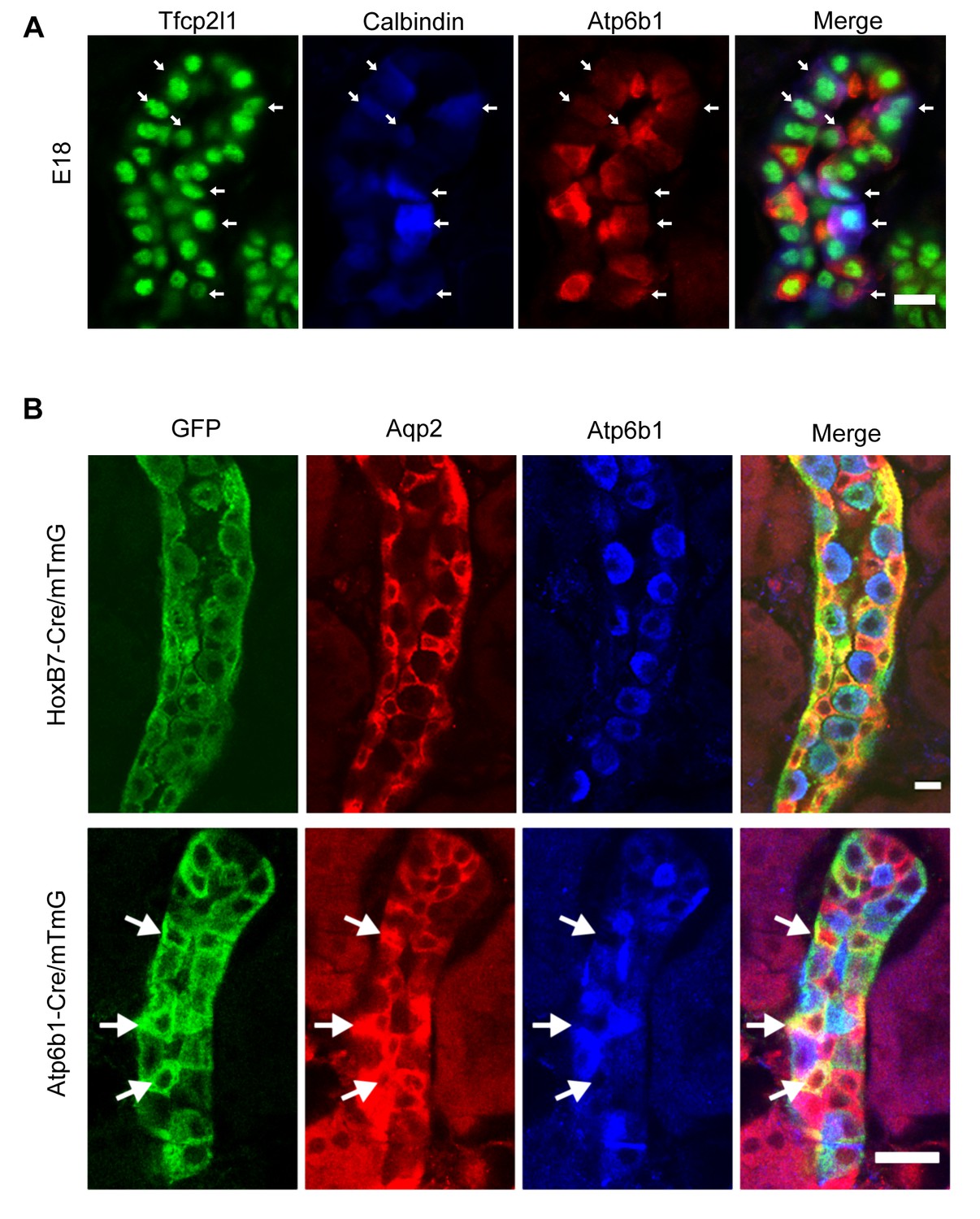 Transcription factor TFCP2L1 patterns cells in the mouse kidney 