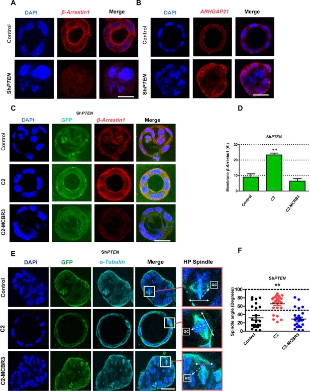 PTEN controls glandular morphogenesis through a juxtamembrane β ...