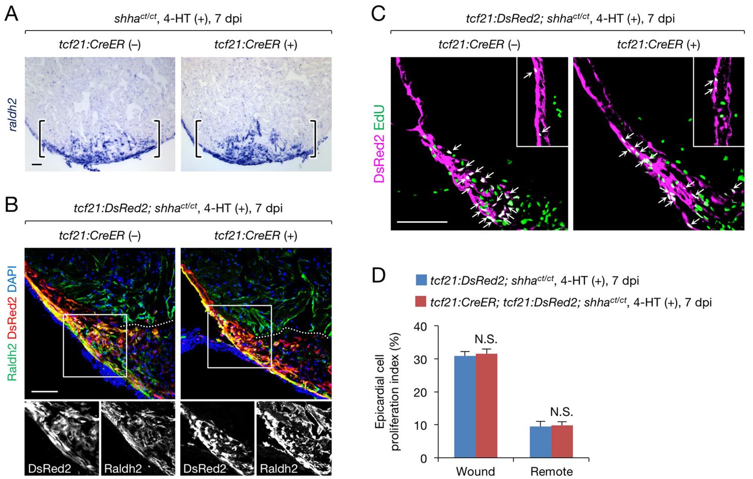Figures and data in Dissection of zebrafish shha function using site