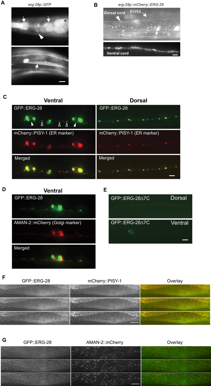 Vruchtbaar club Een deel ERG-28 controls BK channel trafficking in the ER to regulate synaptic  function and alcohol response in C. elegans | eLife