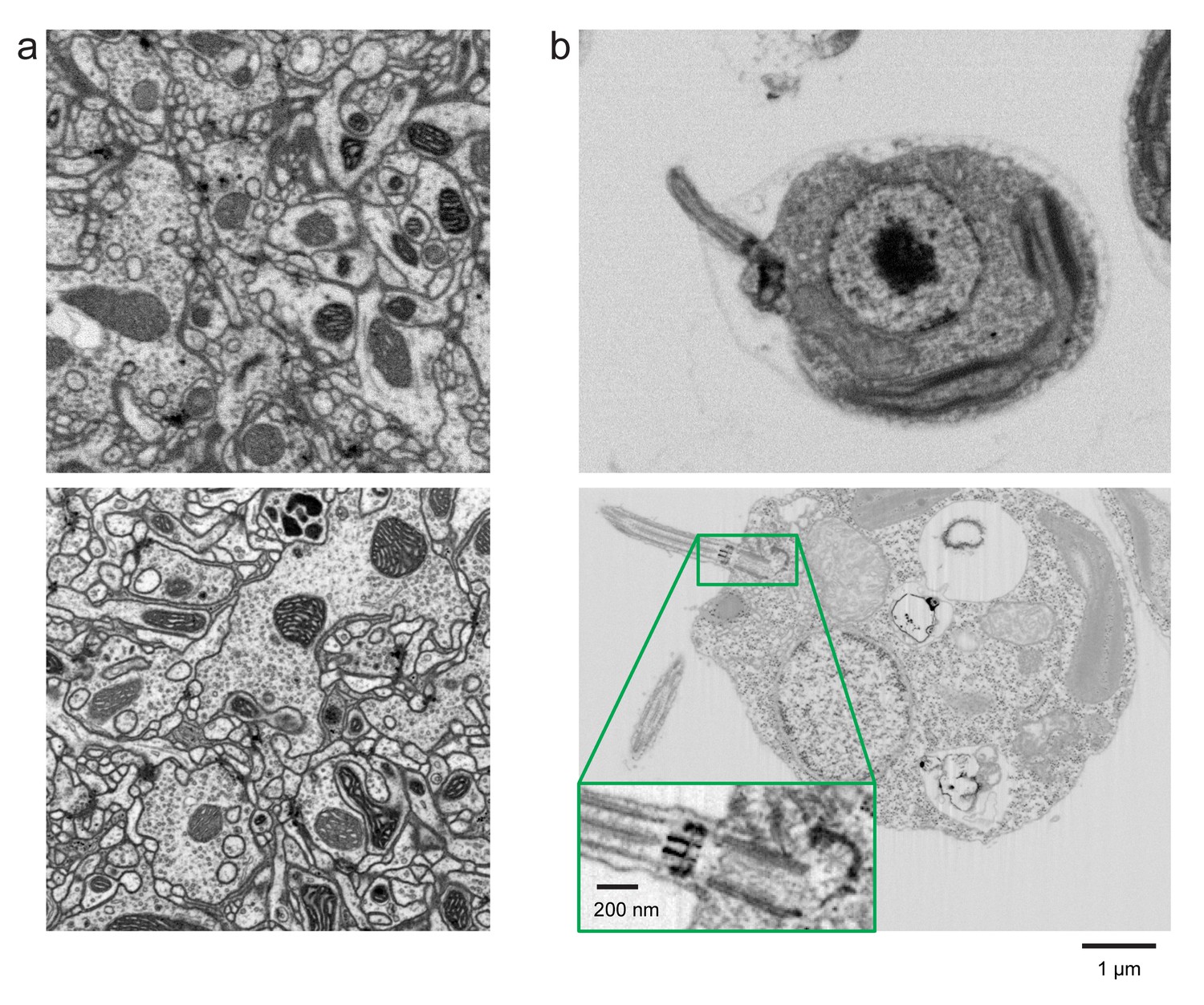 Figures And Data In Enhanced FIB-SEM Systems For Large-volume 3D ...