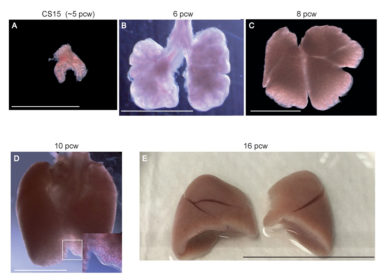 Figures And Data In Human Embryonic Lung Epithelial Tips Are