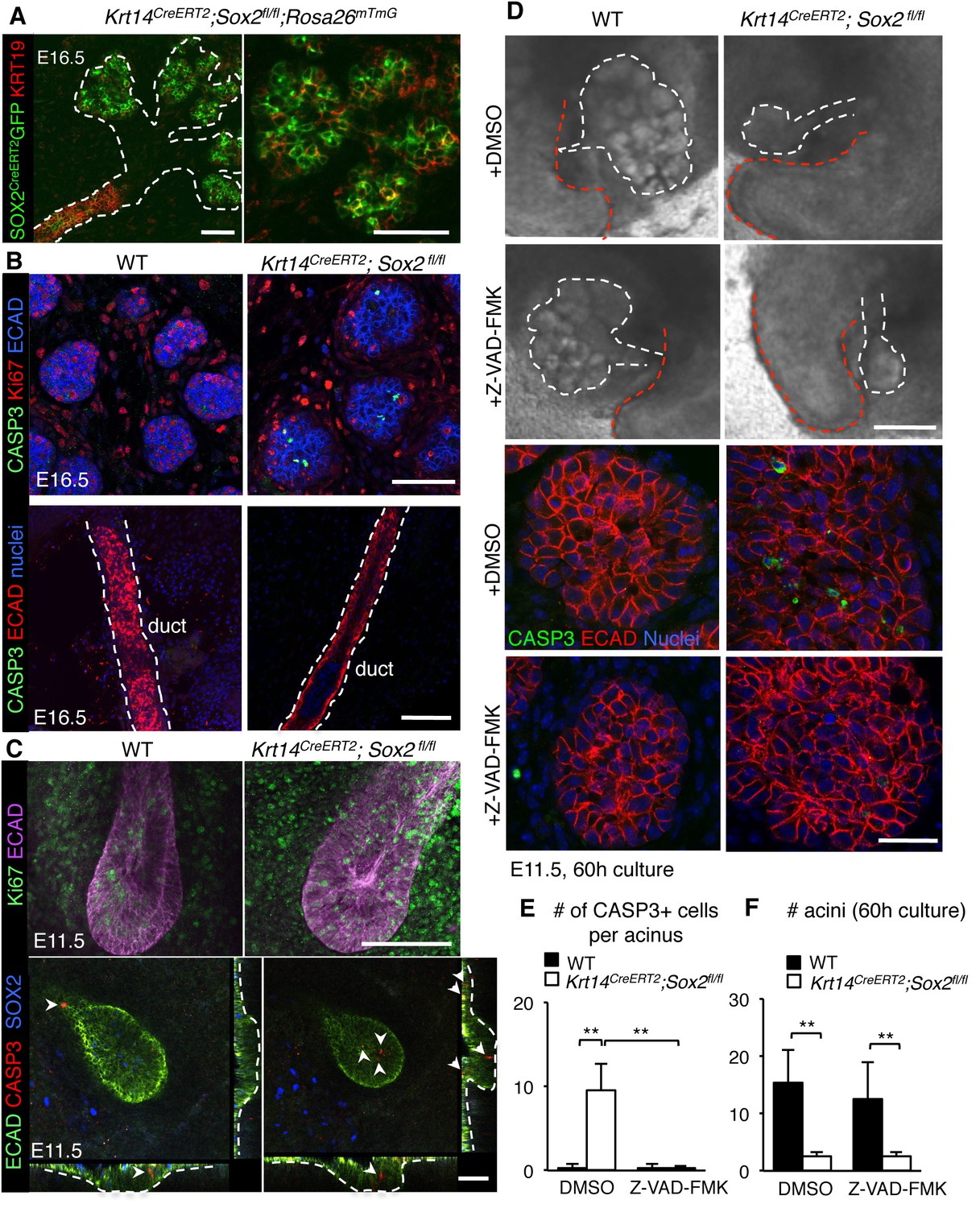 Sox2 Regulates Acinar Cell Development In The Salivary Gland Elife 5867