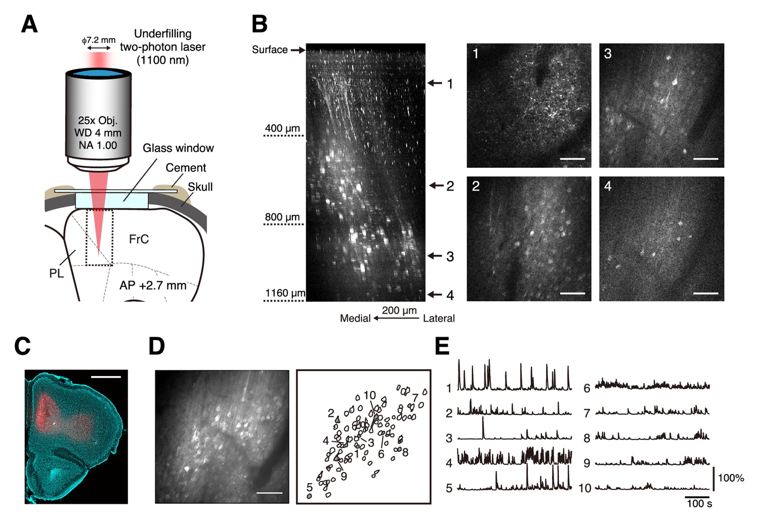 Figures And Data In Two Photon Calcium Imaging Of The Medial Prefrontal