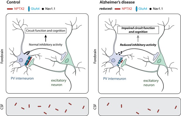 Alzheimer’s Disease: Identifying faulty brain circuits | eLife