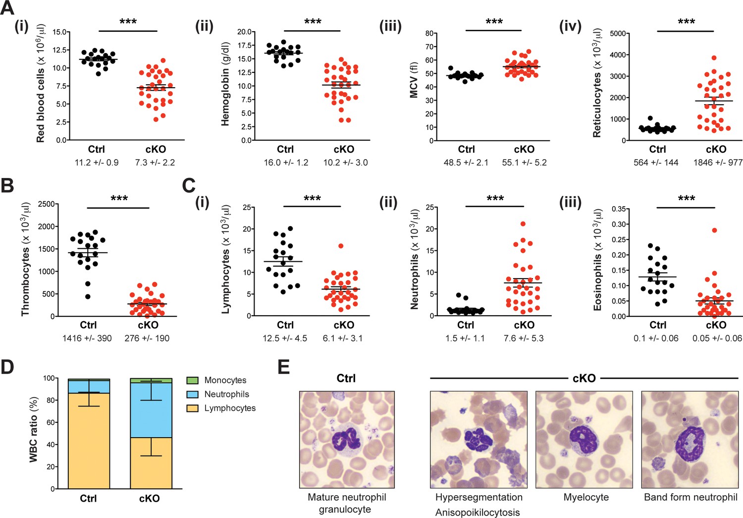 Histone methyltransferases Setd1b increases H3K4me3 level to