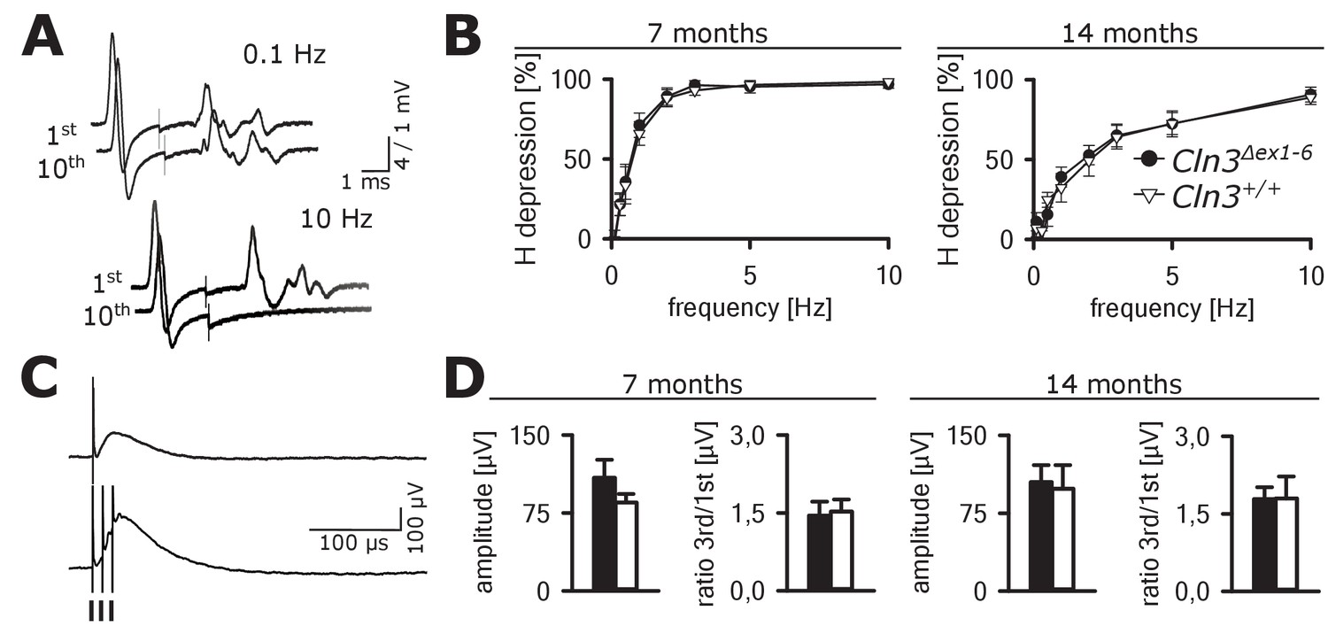 Figures and data in Defective synaptic transmission causes disease ...