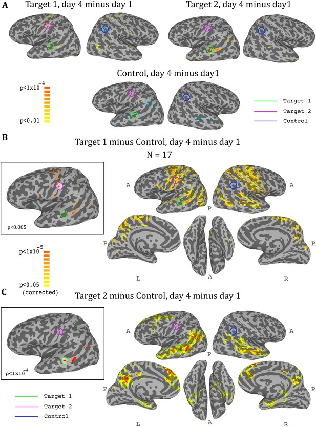 Figures And Data In Direct Modulation Of Aberrant Brain Network ...