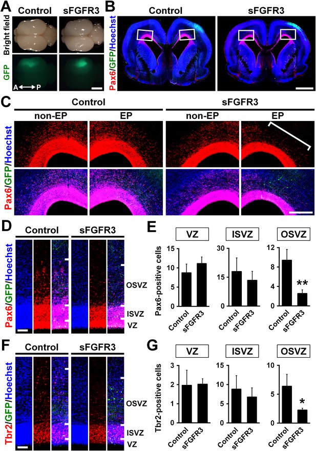 Gyrification Of The Cerebral Cortex Requires FGF Signaling In The