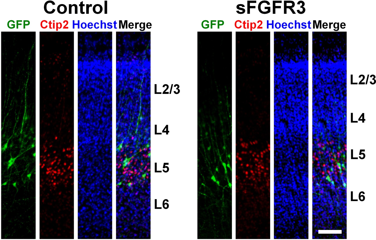 Figures And Data In Gyrification Of The Cerebral Cortex Requires Fgf