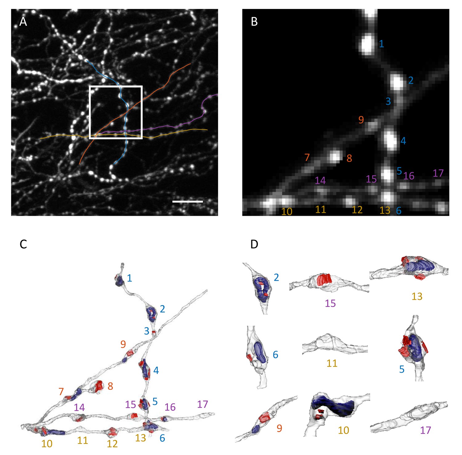 Computer assisted detection of axonal bouton structural
