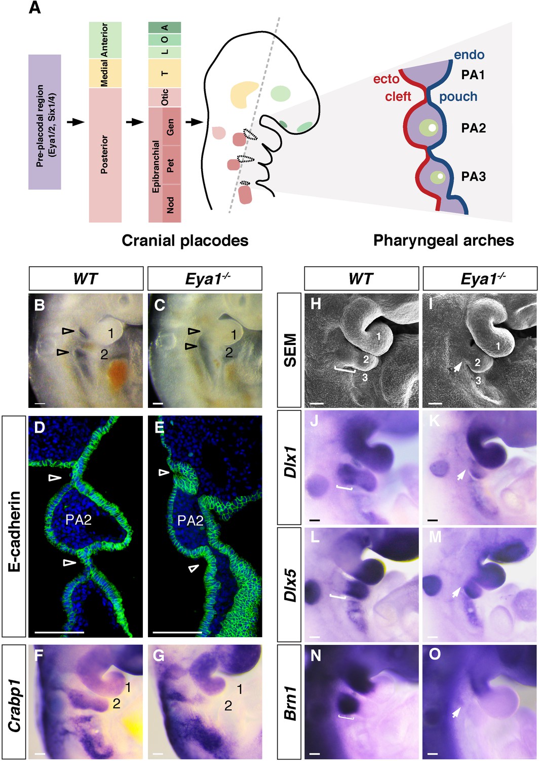 An Eya1-Notch axis specifies bipotential epibranchial