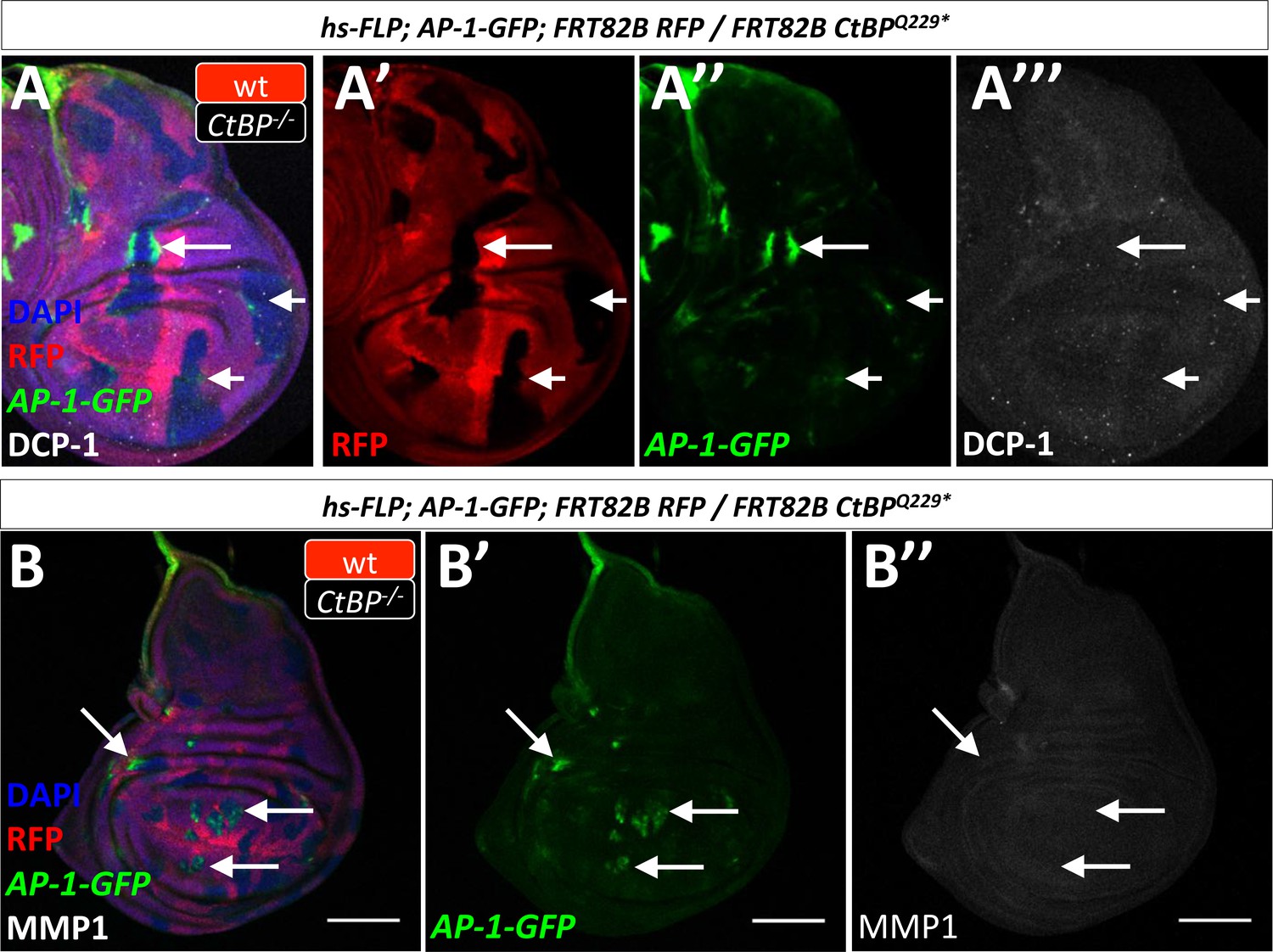 Panicsmileビカクシダ　Jenny 胞子　管理番号 B Kisspeptin/Neurokinin B/Dynorphin (KNDy) cells as