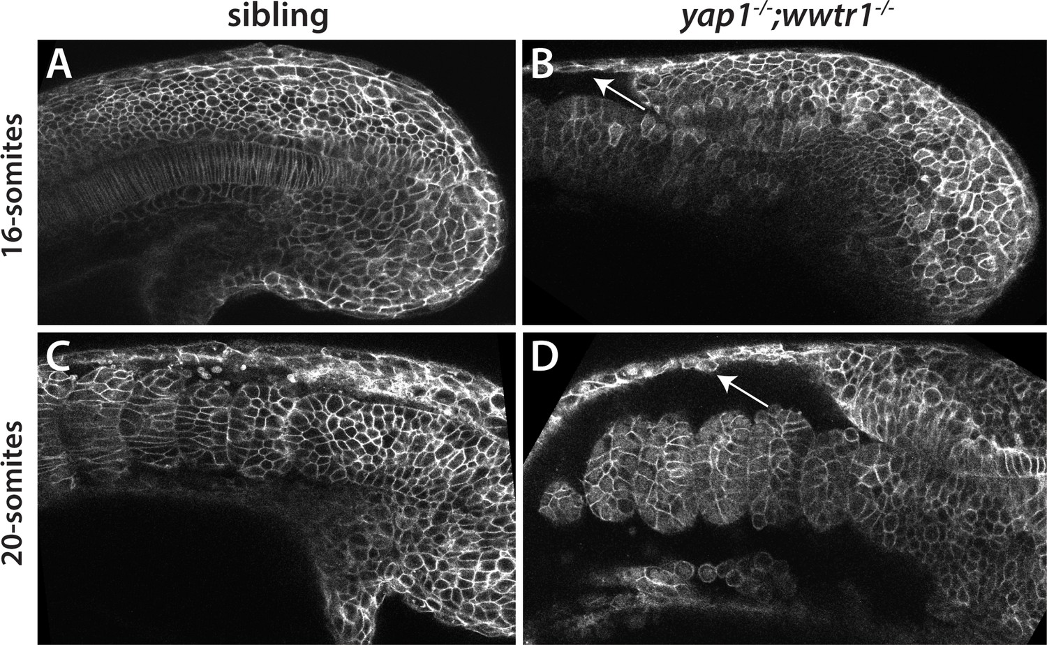 Regulation of posterior body and epidermal morphogenesis in Regulation of posterior body and epidermal morphogenesis in