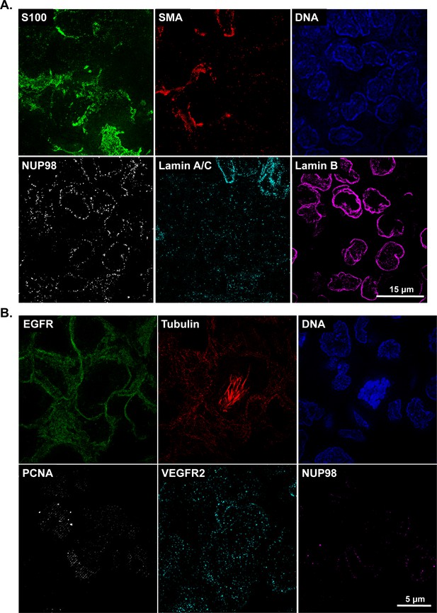 Figures And Data In Highly Multiplexed Immunofluorescence Imaging Of Human Tissues And Tumors 6028