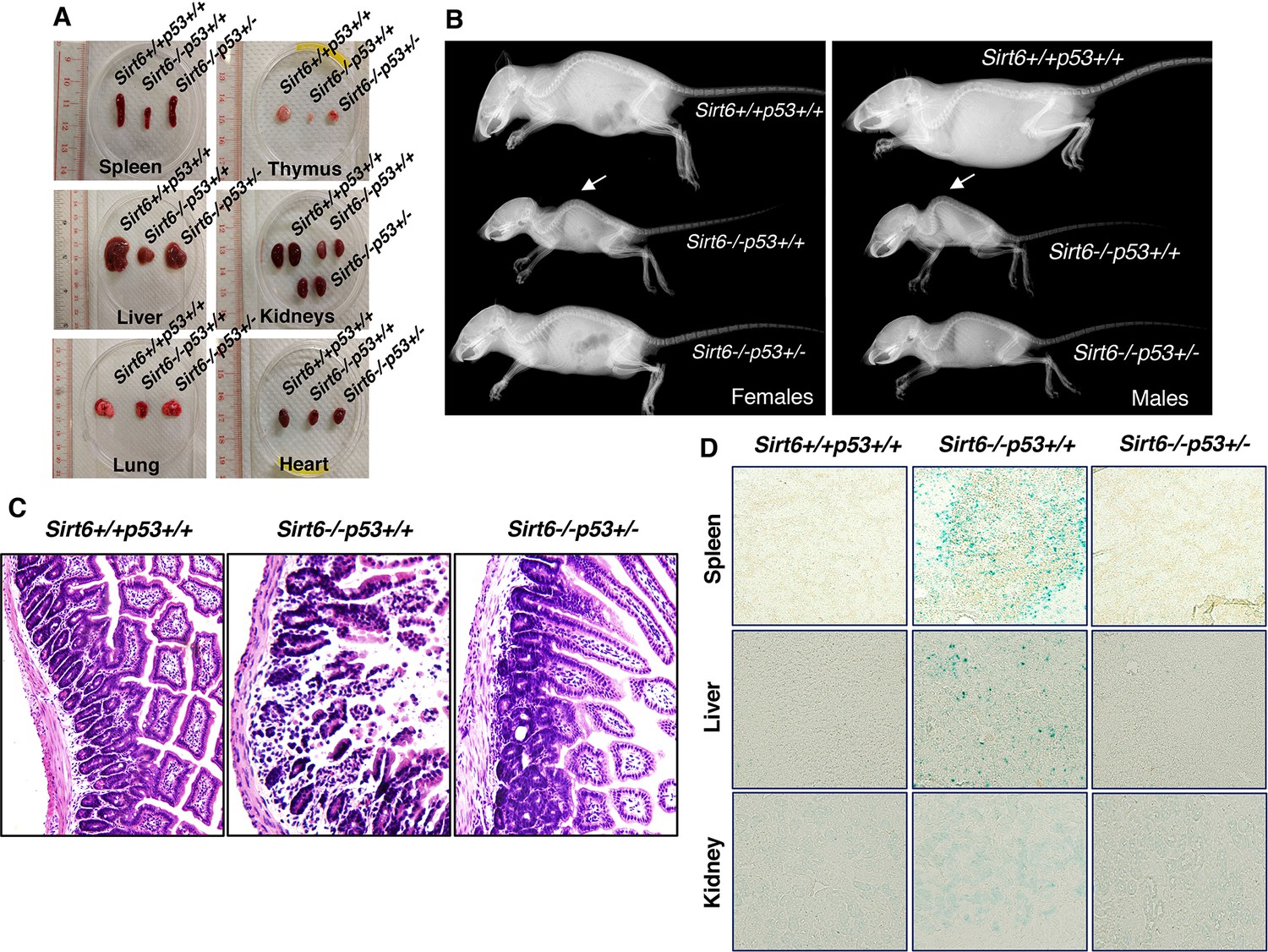 Haploinsufficiency Of Trp53 Dramatically Extends The Lifespan Of Sirt6 ...