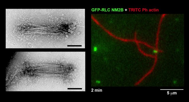 Bipolar Filaments Of Human Nonmuscle Myosin 2-A And 2-B Have Distinct ...