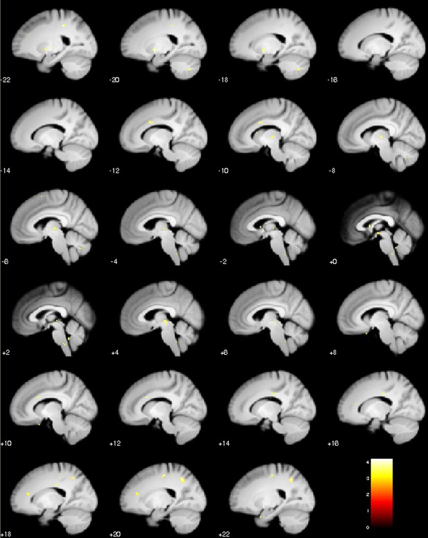 Figures and data in The periaqueductal gray and Bayesian integration in ...