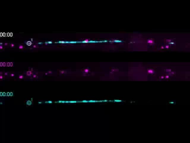 Figures and data in Multivesicular bodies mediate long-range retrograde ...