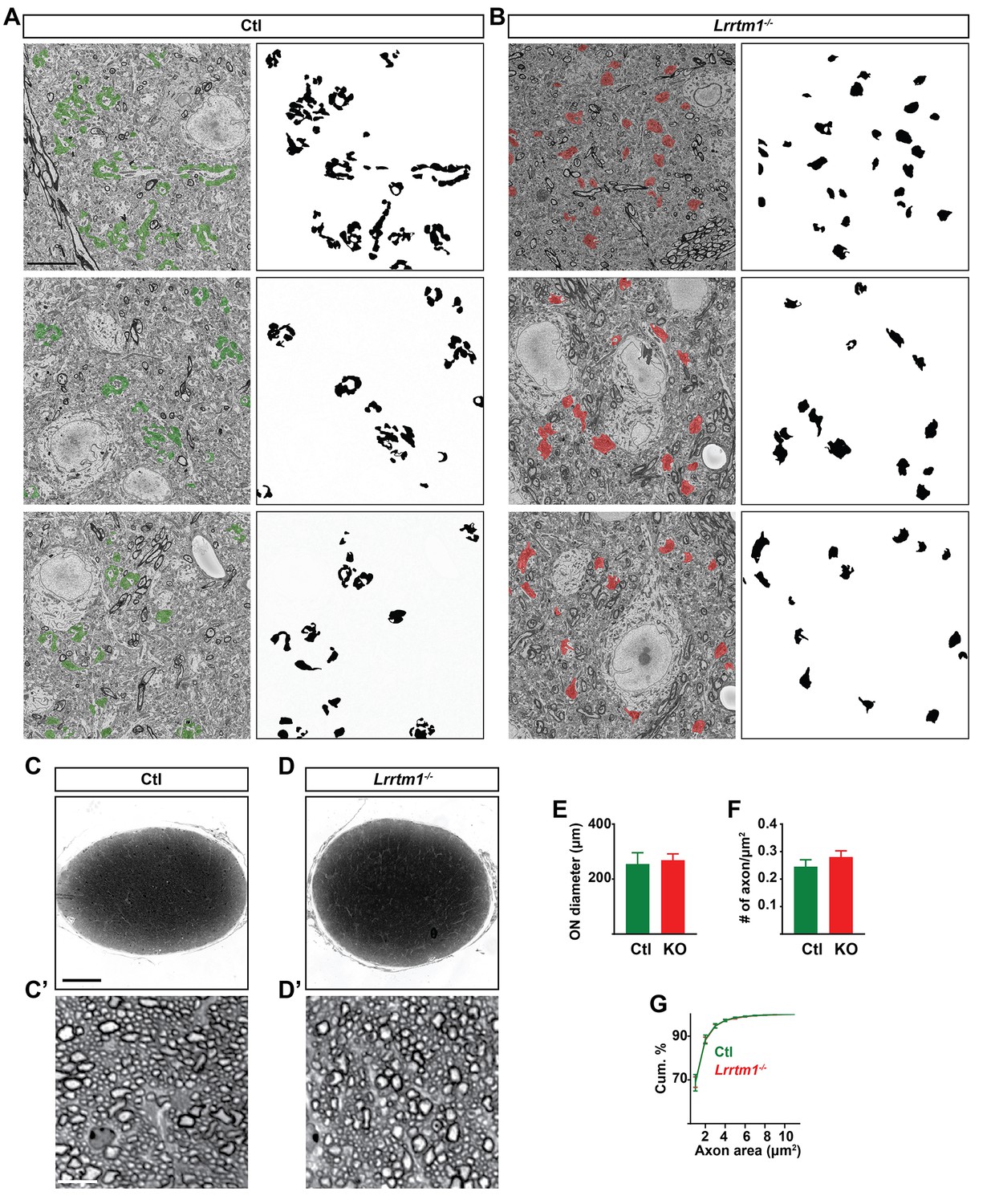 Figures and data in LRRTM1 underlies synaptic convergence in visual ...