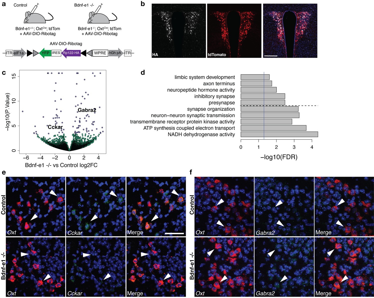 TrkB-expressing paraventricular hypothalamic neurons suppress