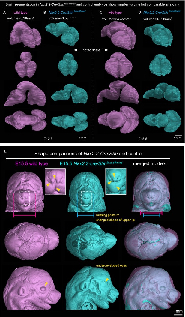 Figures and data in Signals from the brain and olfactory epithelium ...