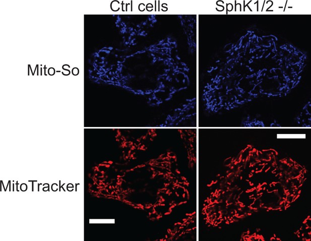 Figures And Data In Mitochondria Specific Photoactivation To Monitor