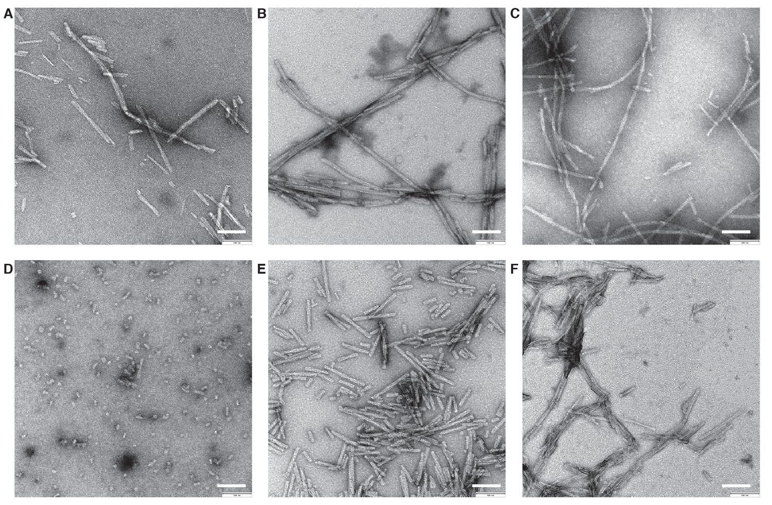 Figures And Data In Cryo EM Structure Of Alpha Synuclein Fibrils ELife