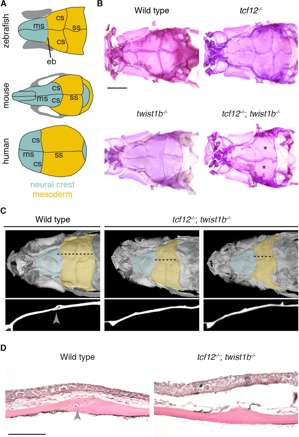 Altered bone growth dynamics prefigure craniosynostosis in a zebrafish
