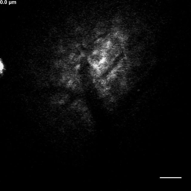 Figures and data in Metformin reverses early cortical network ...