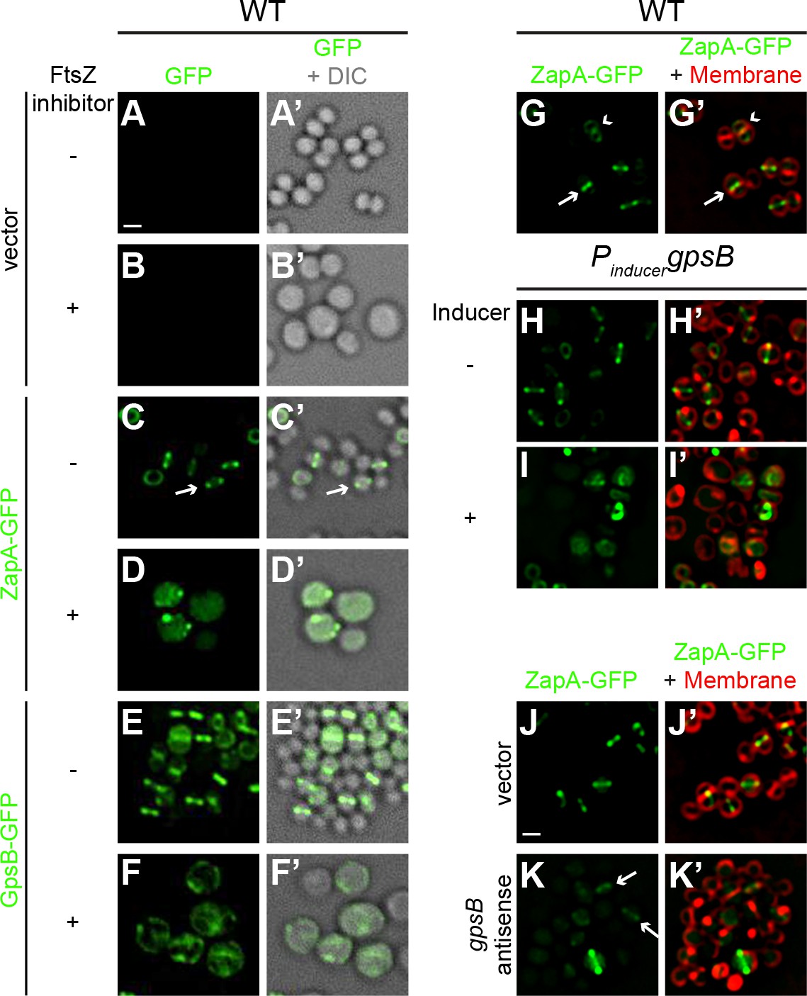 An Essential Staphylococcus Aureus Cell Division Protein Directly