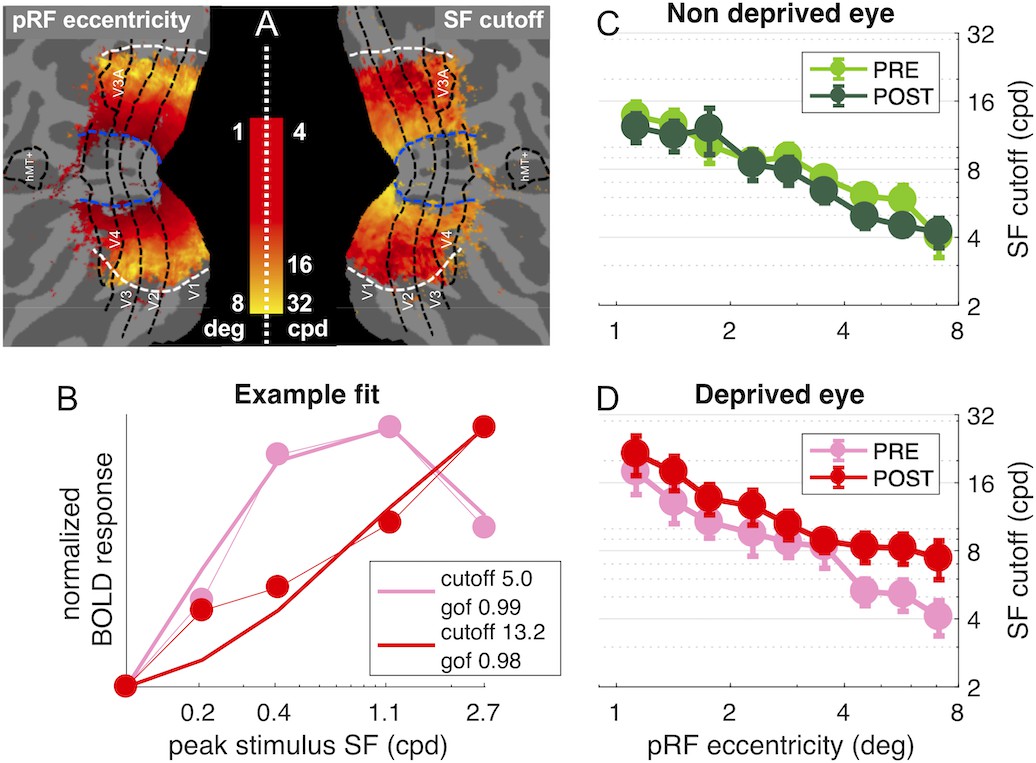 Figures and data in Response to short-term deprivation of the human ...